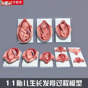 胎儿生长发h育过程模型女性怀孕妊娠十月分娩妇幼保健妇产科学1比
