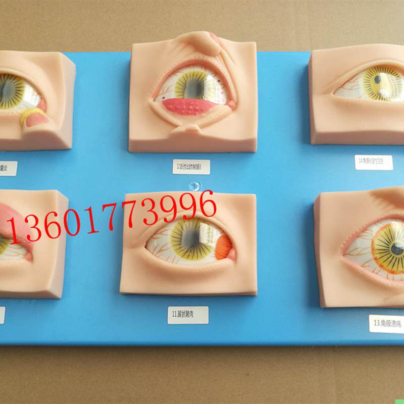 人体常见眼病模型常用眼科疾病模具眼病模型20种常见眼球病变模型