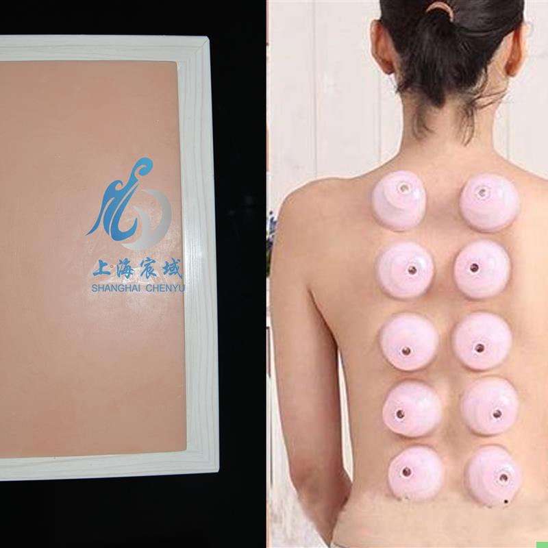 医用拔火罐手法训练模型