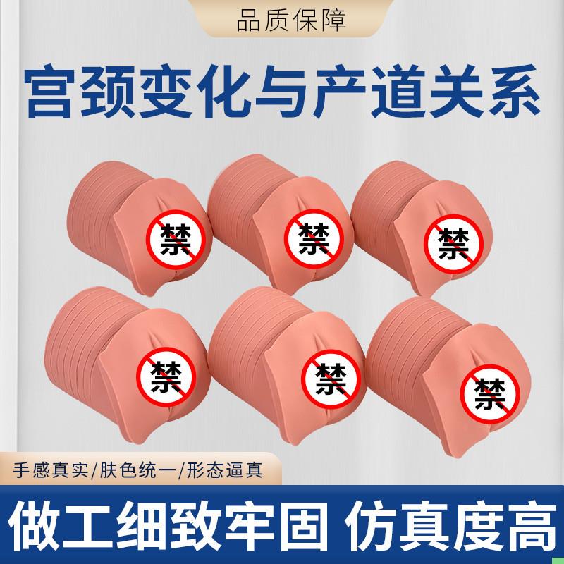 教学模型 女性分娩生产宫口模型 产前宫颈变化与产道关系模型