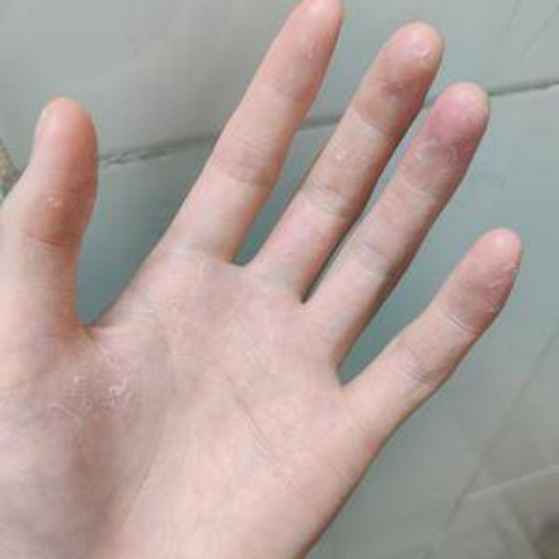 摸摸恢复手脱皮修复霜季节性手掌手指干裂手上起皮干燥掉皮脚干裂