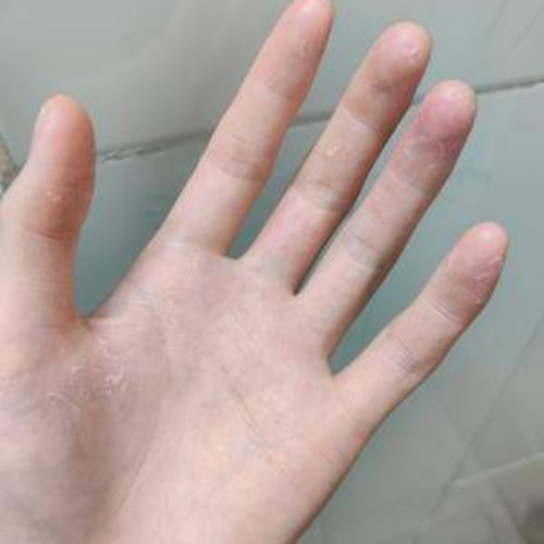摸摸恢复手脱皮修复霜季节性手掌手指干裂手上起皮干燥掉皮脚干裂