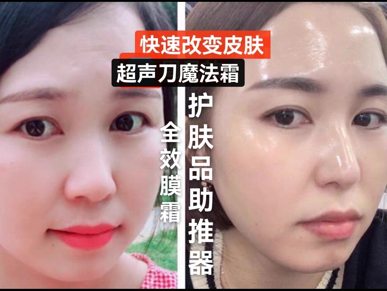 【很自信的推荐】多效合一膜霜 擦了两年护肤品 没改善 一定要用
