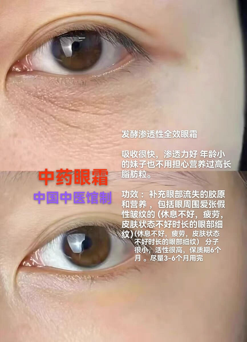 〖中国人要用中药眼霜】综合调理眼部问题 全效调理