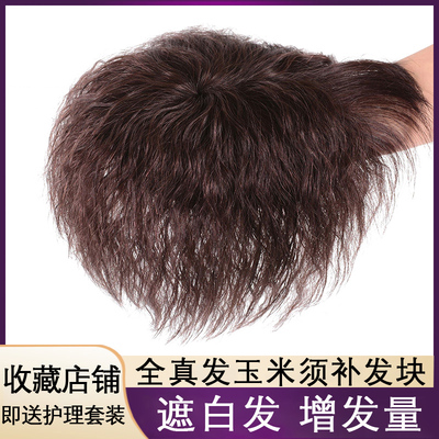 假发女头顶补发块卷发中老年逼真
