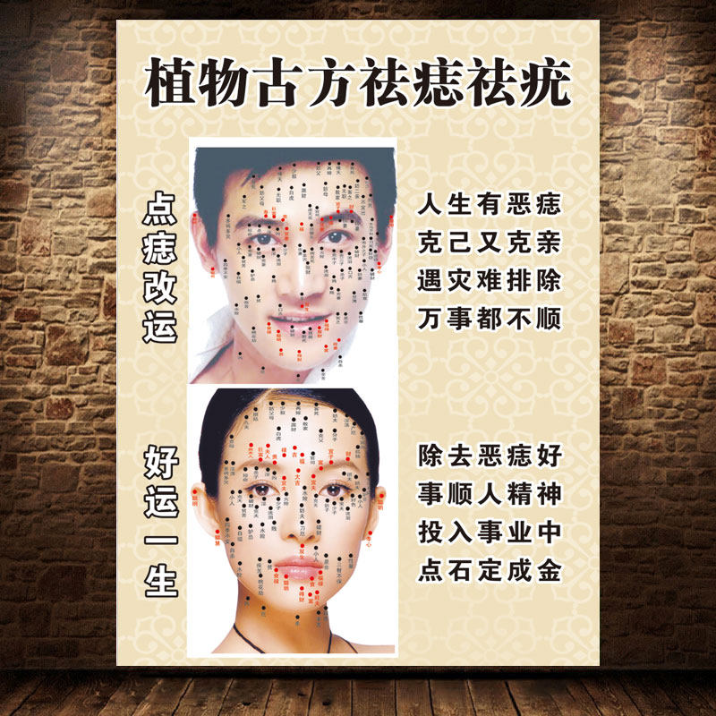 面痣图祛痣海报脸部取痣宣传画面部点痣图祛痣面相广告画挂图2061