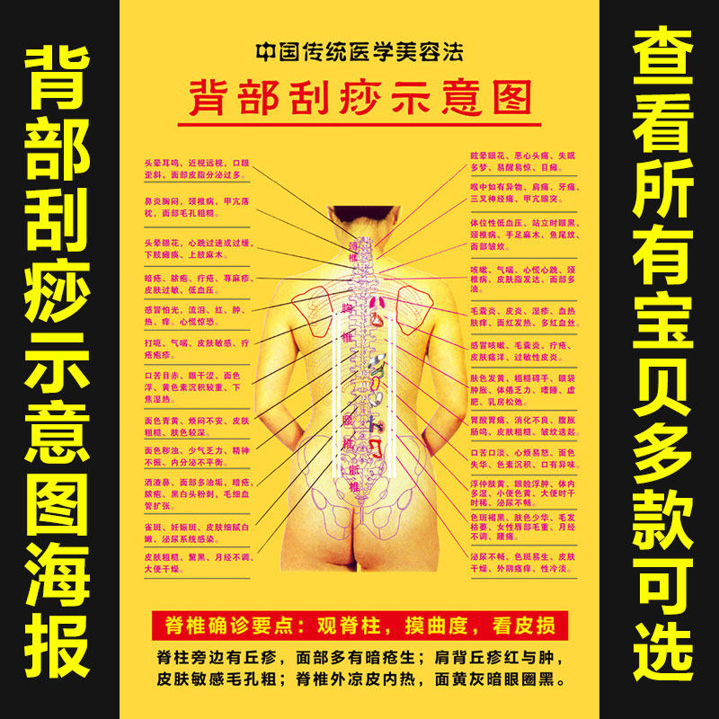 背部刮痧示意图养生馆美容人体穴位挂图 中医宣传海报 脊背确诊,个性定制/设计服务/DIY,写真/海报印制,淘宝优惠券,粉丝福利购,淘宝优惠卷
