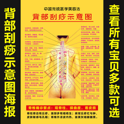 刮痧人体穴位脊背确诊宣传海报
