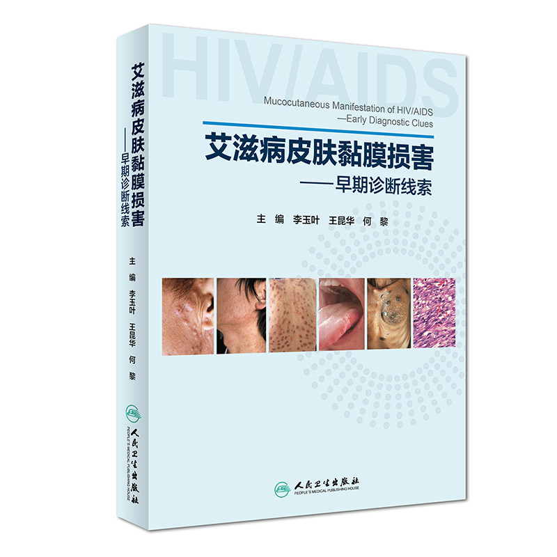 艾滋病皮肤黏膜损害一早期诊断线索李玉叶王昆华何黎主编人民卫生
