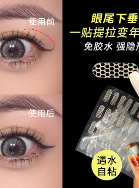 一贴拯救眼尾下垂/眼中塌陷