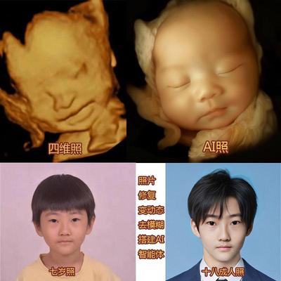 宝宝四维AI照片预测彩超胎儿长相生成孕检B超婴儿成像儿影像精修
