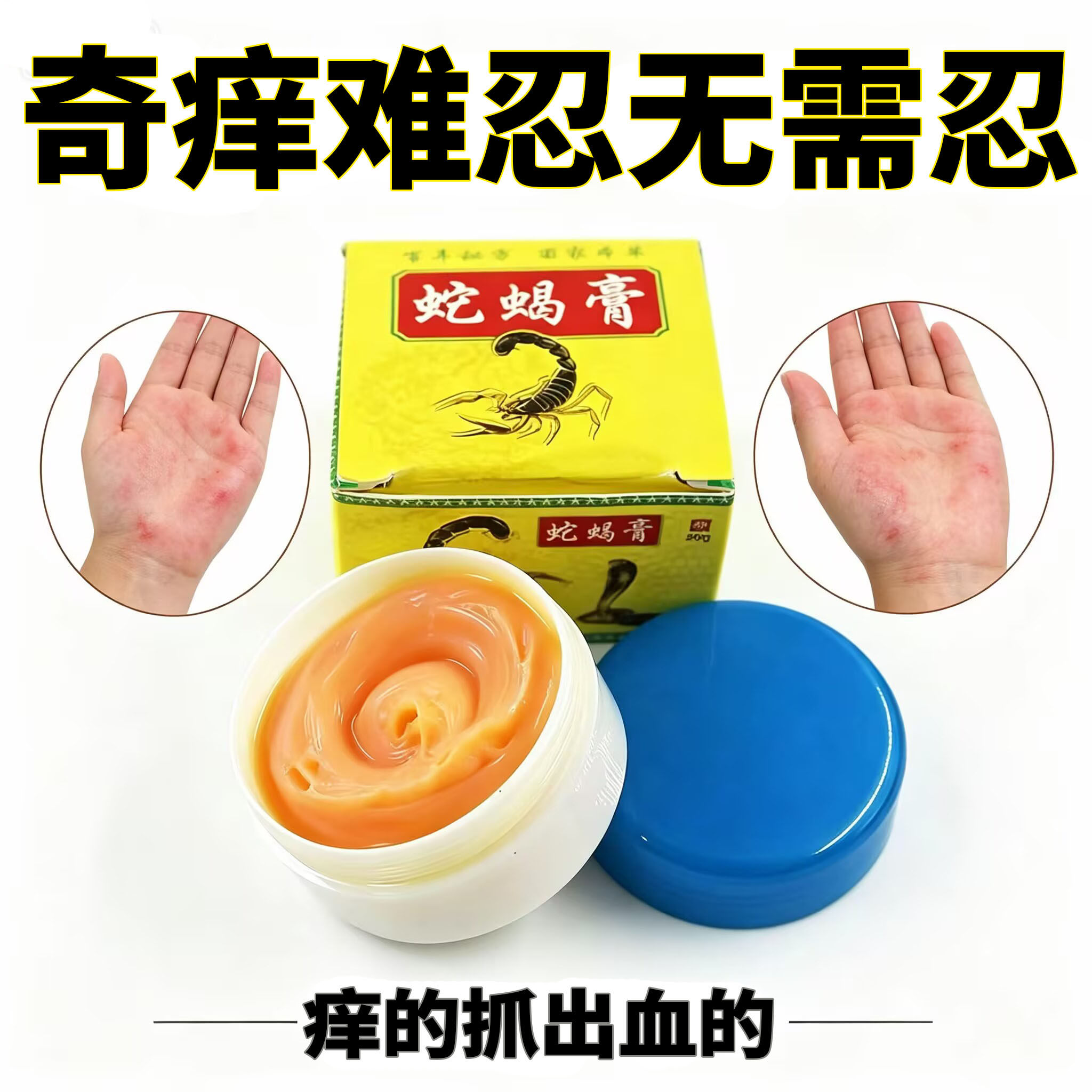 土苗郎蛇蝎膏老牌子草本乳膏皮肤痒身上痒全身痒膏蚊虫叮咬跳蚤咬