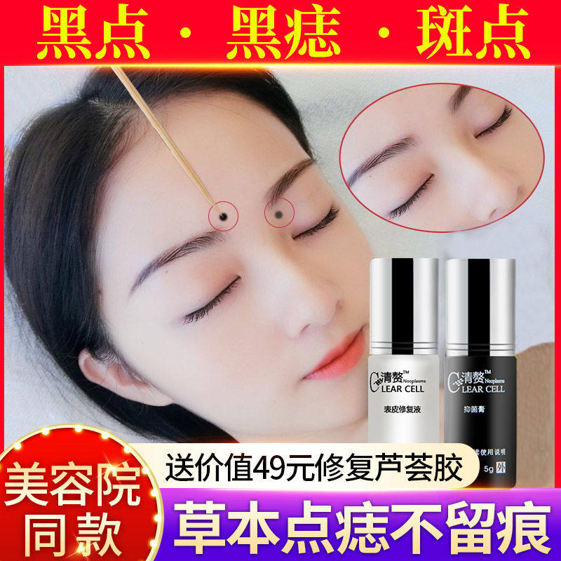 清赘套装疙瘩五慈膏去肉丁志黑点指导用官方正品5g