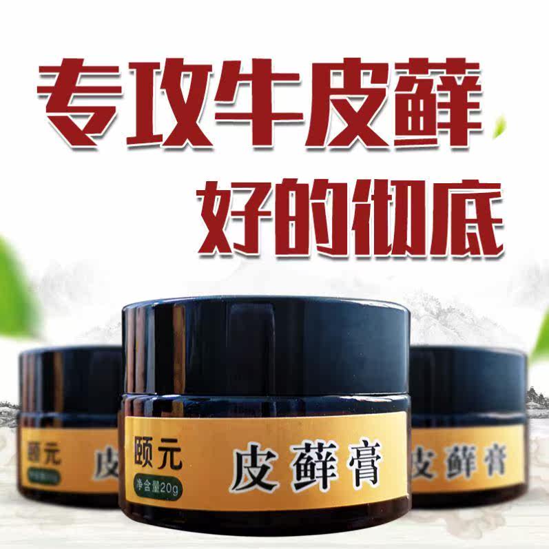 药膏真菌感染除螨药膏牛皮藓治根苗药膏治疗干疮的药跳蚤咬的药膏