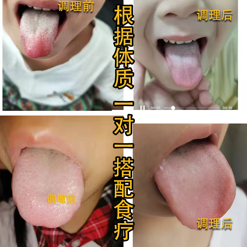 一对一配制 药食同源 养生保健 儿童调理脾胃早餐食疗四神茶
