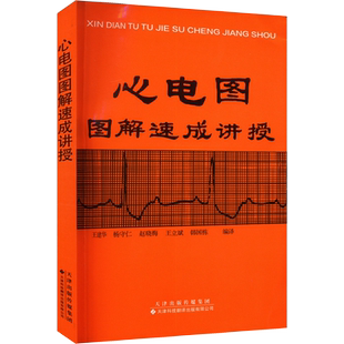 心电图图解速成讲授