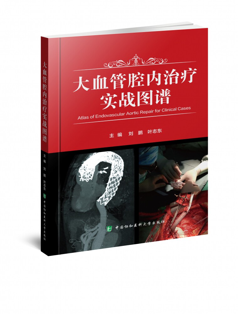 大血管腔内治疗实战图谱 官方正版 博库网