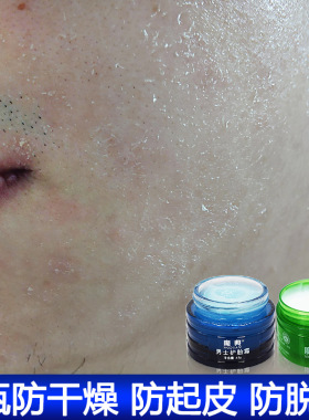 男脸霜面油电焊工烧焊点焊防强光线擦脸修复脱皮保养皮肤护肤用品