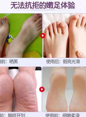 日本马油足膜去死皮老茧角质脚后