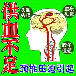 头晕膏眩晕药头疼头晕神器颈椎压迫神经缓解头昏专用 头晕克星