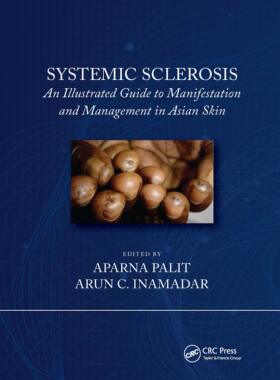 预售 按需印刷 Systemic Sclerosis
