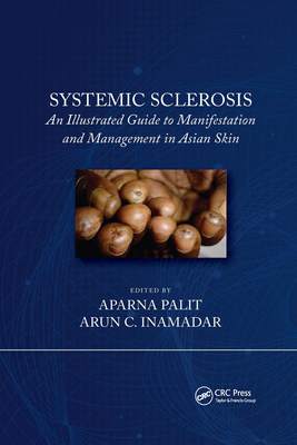 预售 按需印刷 Systemic Sclerosis