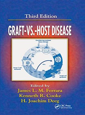 预售 按需印刷 Graft vs. Host Disease