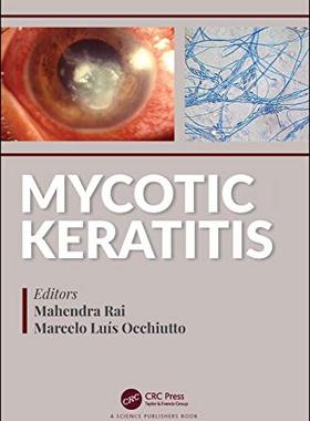 预售 按需印刷 Mycotic Keratitis