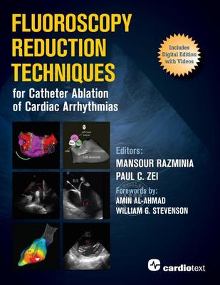 【预售 按需印刷】 Fluoroscopy Reduction Techniques for Catheter Ablation of Cardiac Arrhythmias