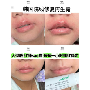 韩国院线医美术后光电破皮过敏发红屏障受损日常修复再生霜45ml