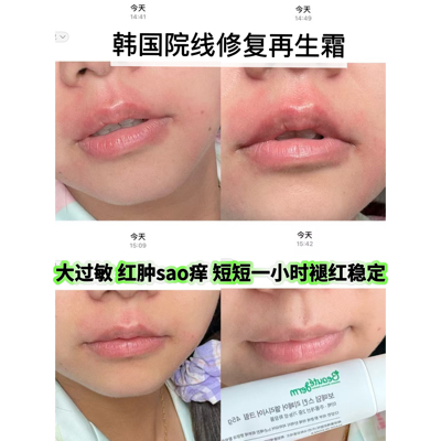 韩国宝德顿Beautederm再生面霜