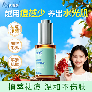 贝倍舒青少年祛痘去黑头粉刺精华液男女敏感肌温和祛痘收缩毛孔