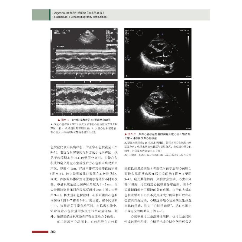 feigenbaum超声心动图学 原书第8版