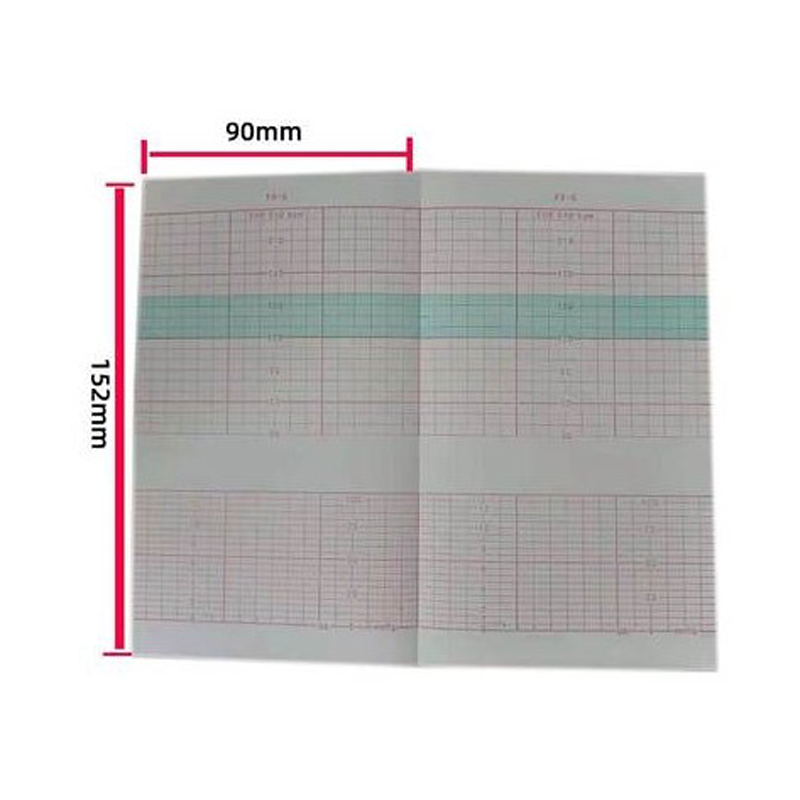 胎监纸 胎心检测仪记录纸 胎儿心电图打印纸 适用理邦F9F6科曼C20