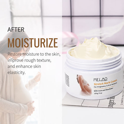 新品跨境妊娠霜产后修护霜妈咪纹肚子纹霜 Stretch Mark Cream