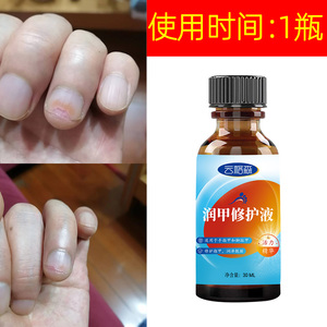 德国甲空修复液指甲分离甲剥分层离脚趾甲厚干长新甲生长液正30ml