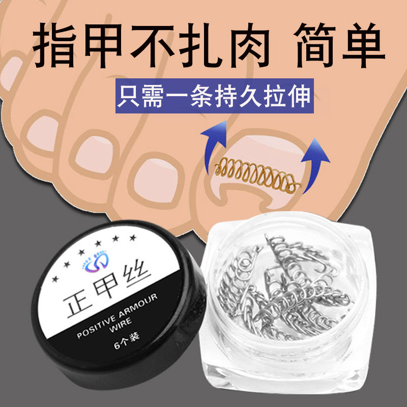 正甲丝甲沟嵌甲专用矫正器脚趾甲矫正贴卷甲指甲长肉里纠正炎贴片,家庭/个人清洁工具,美甲/修甲套装,淘宝优惠券,粉丝福利购,淘宝优惠卷