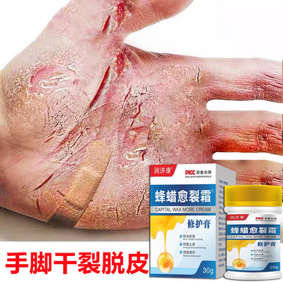 手足脚后跟干裂足霜手脱皮起皮滋润补水护手霜开裂干燥硬皮脚跟