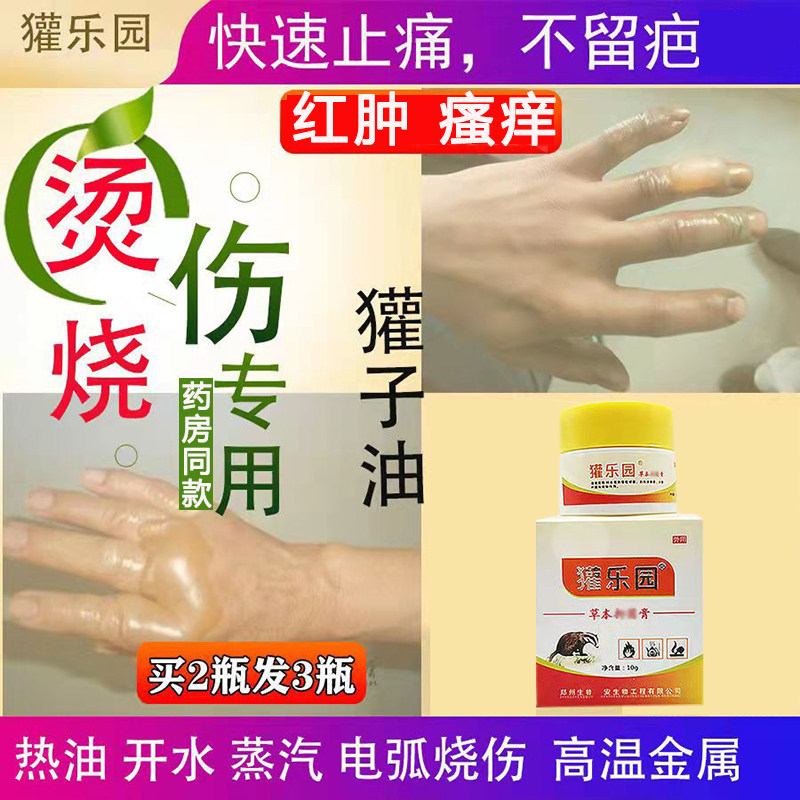 獾狗油力轻乐园抑菌狗纯獾子烫伤油烧烫伤膏不留疤欢子油买2送1