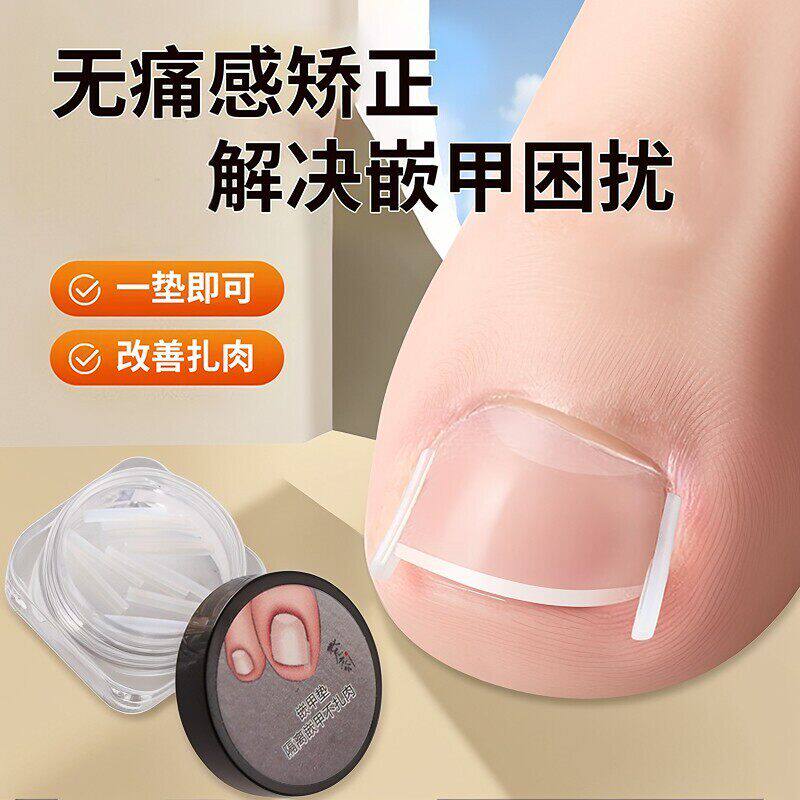甲沟矫正器填充垫片嵌甲神器防脚指甲往肉里长专用治疗工具甲贴片