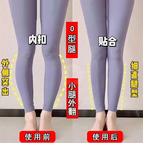 足内翻o型腿右脚内翻矫正器鞋垫