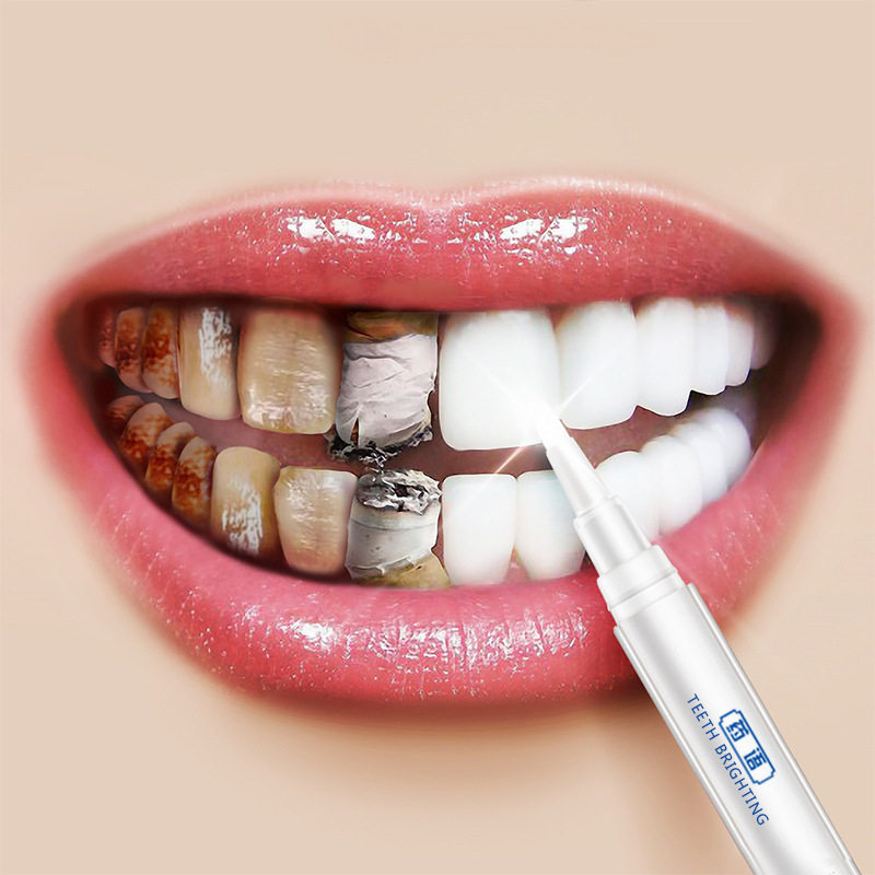Tooth Bleach Tooth Dirt Teeth Whitening Tooth black Dirt Tooth How doin the Care cleaners/Sanitary napkins/Paper/Aromatherapy , Shampoo bath/Personal cleanliness , Oral Care , Teeth whitening bleaching agent  category - from Buy2taobao.com to provide professional Taobao agent buy service