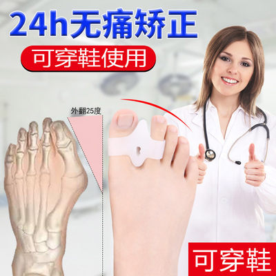 日本硅胶大脚骨可穿鞋外翻矫正器