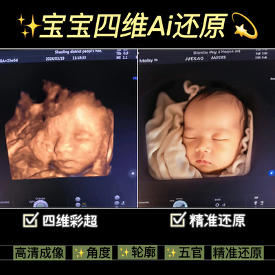 宝宝四维彩超ai照片还原高清修复