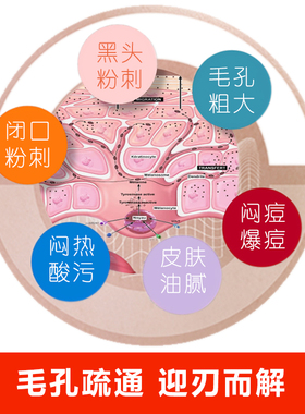NPBIO痘痘修复面膜疏通毛孔堵塞去痘印祛粉刺深层清洁补水膜7张