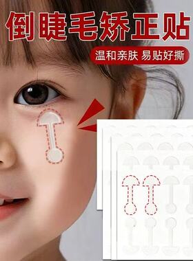 倒睫毛矫正贴儿童隐形婴儿下眼睑倒睫贴成人眼皮下垂提拉眼贴免裁