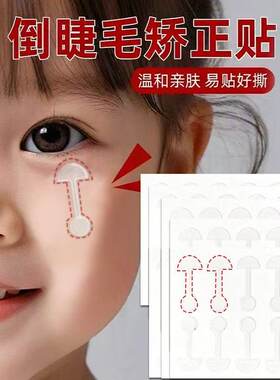 倒睫毛矫正贴儿童隐形婴儿下眼睑倒睫贴成人眼皮下垂提拉眼贴免裁