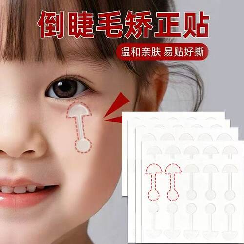 倒睫毛矫正贴儿童隐形婴儿下眼睑倒睫贴成人眼皮下垂提拉眼贴免裁
