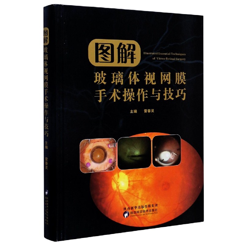 asy 图解玻璃体视网膜手术操作与技巧(精) 编者:雷春灵|责编:付琨 9787536978805 陕西科技