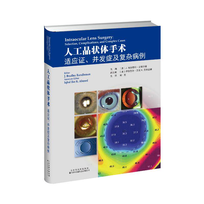 asy 人工晶状体手术适应证并发症及复杂病例 J.布拉德利?兰德尔曼主编 9787543338678 天津科技翻译出版公司